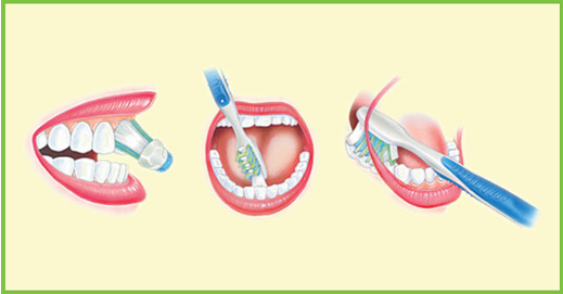 interdental-brushes